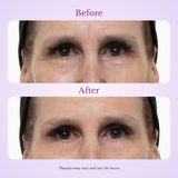 Before and after under-eye firming gel